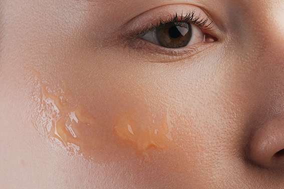 Retinal oder Retinol