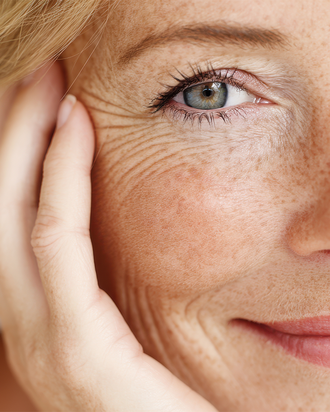 Dry skin during menopause