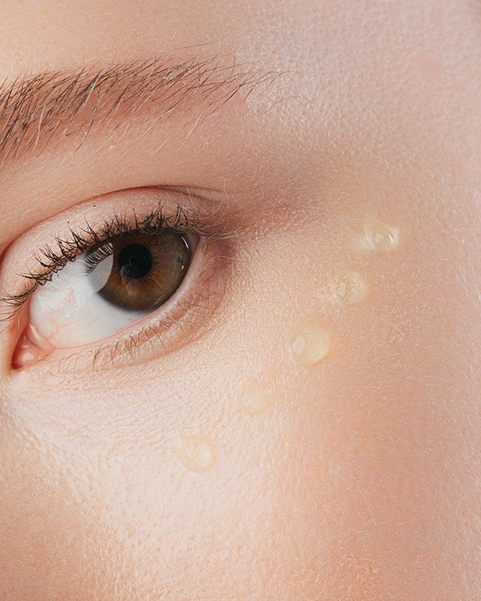 Application of eye care